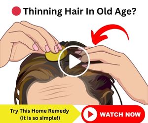 thinning hair